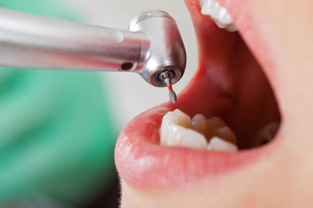 Best Urgent Dental Care for Toothache in Amboy, WA